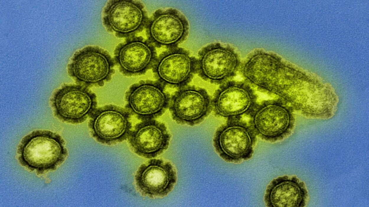Explosion de la grippe dans le Nord-Est : le variant H3N2 inquiète