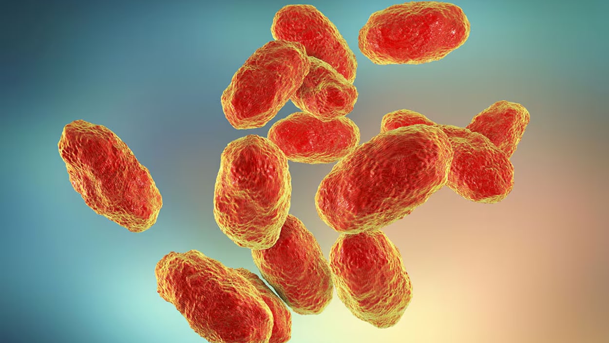 À Calgary, des hôpitaux signalent une infection bactérienne rare