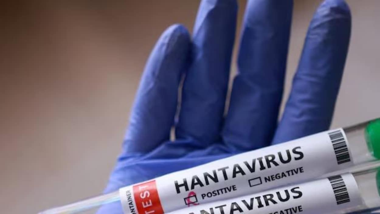 Le patient atteint infecté par l’hantavirus en C.-B. a quitté l’hôpital
