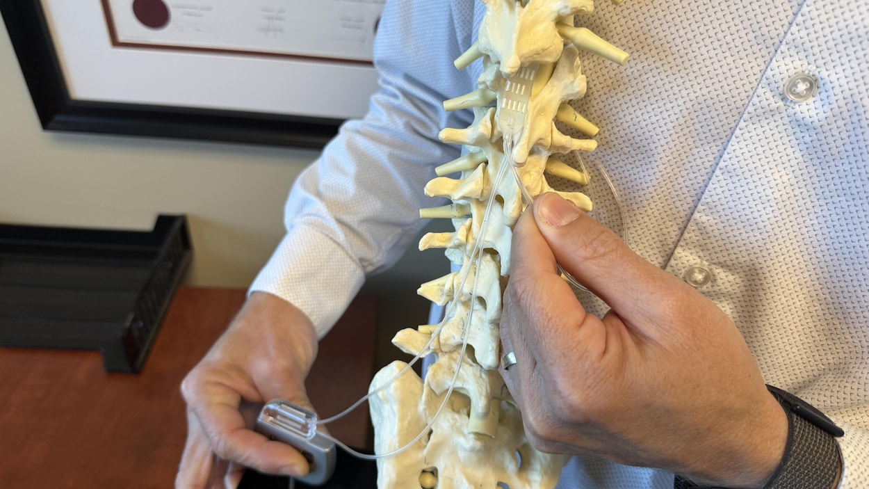 Un implant vertébral transforme la vie de personnes en fauteuil roulant