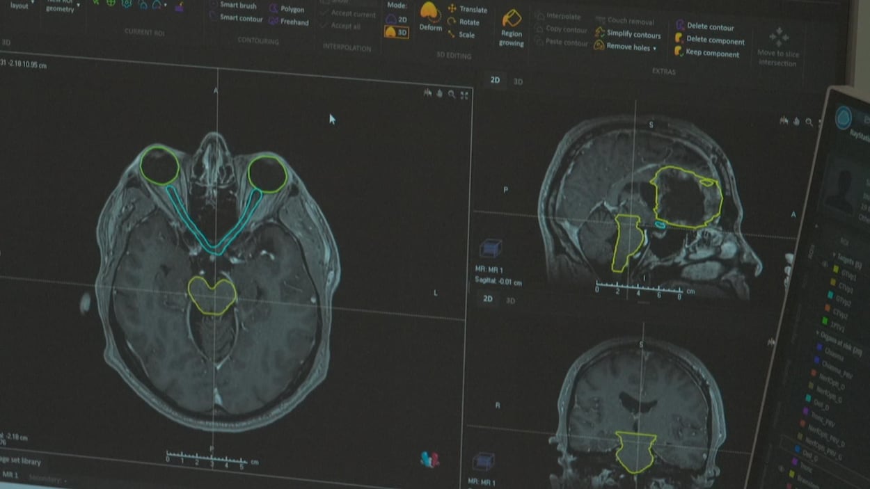 Suspension des services de radiologie aux Escoumins