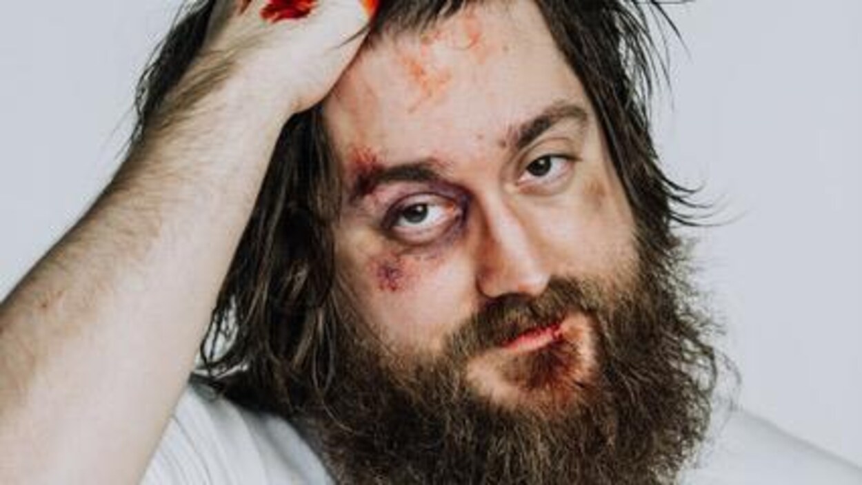 Joey Robin Haché avec le visage marqué de contusions et les mains tachées de sang.