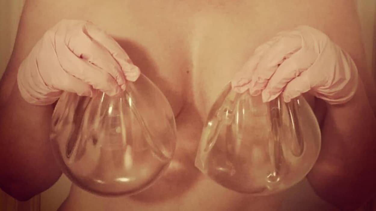 Julie tient de implants mammaires dans ses mains