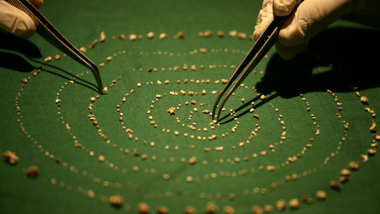 Des centaines de dents minuscules disposées en cercle sur un tissu et deux mains tenant des pinces.