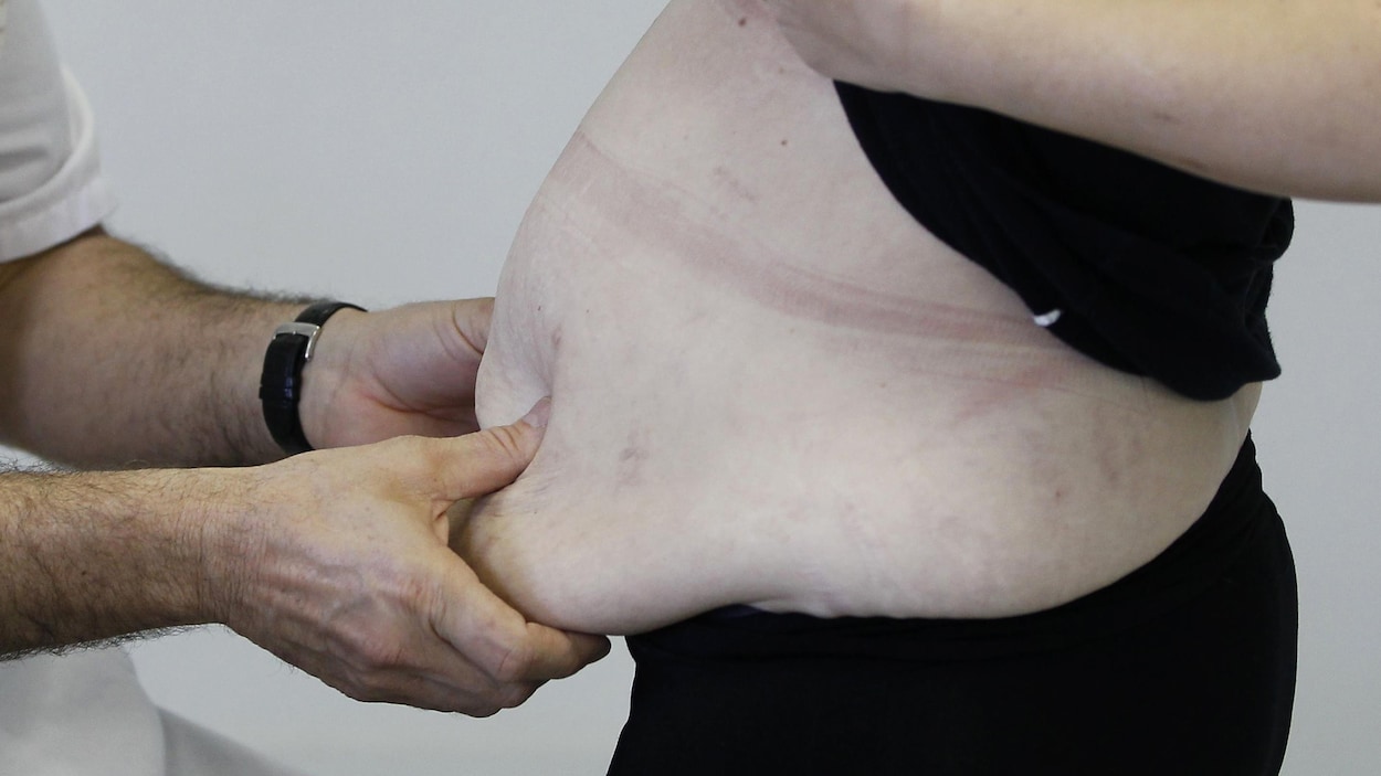 Un homme, qui est médecin, tient le tour de taille assez volumineux d'une femme Un homme, qui est médecin, tient le tour de taille assez volumineux d'une femme
