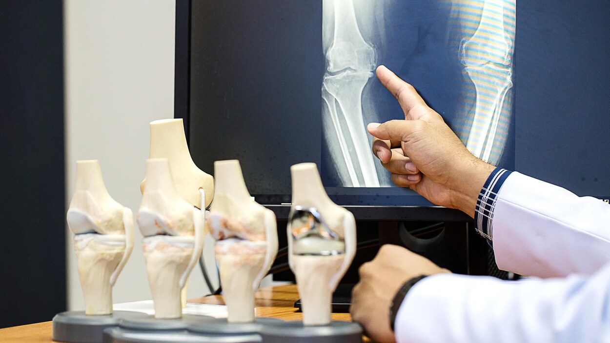 Un médecin pointe du doigt un genoux sur une radio.