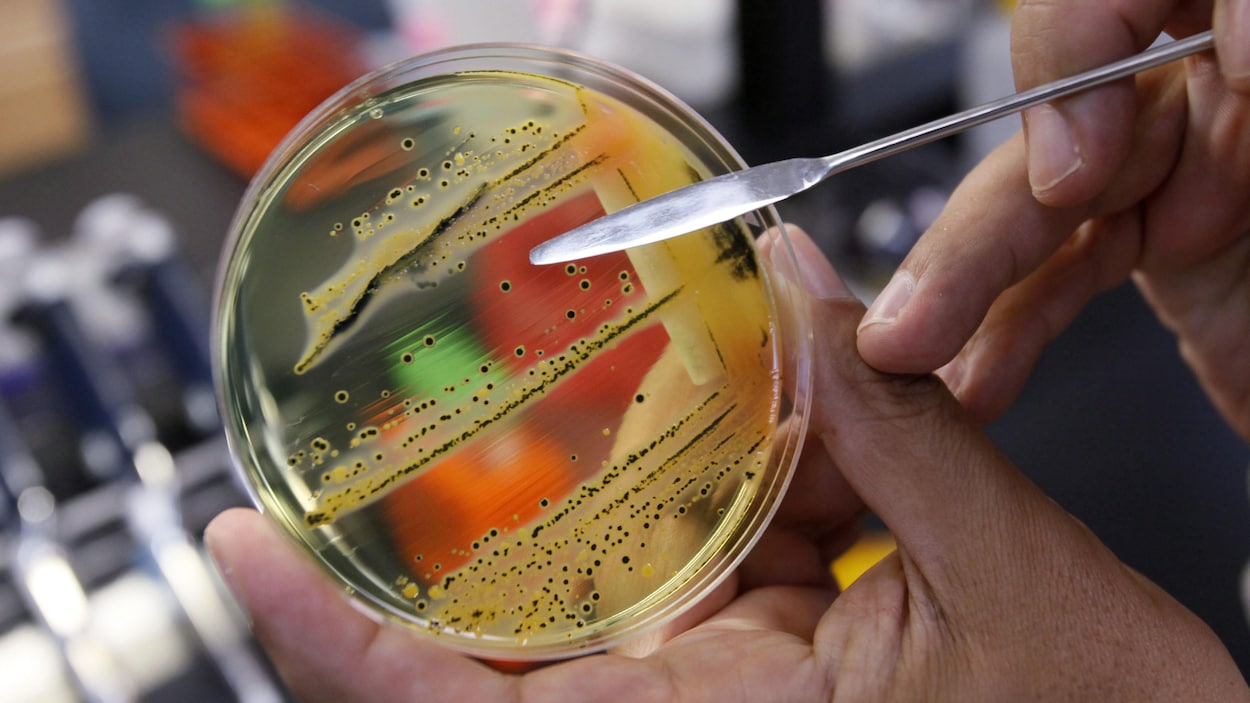 Une culture de salmonelle en laboratoire.