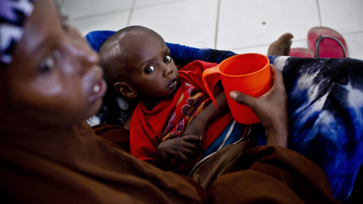 Une mère somalienne tient dans ses bras son fils souffrant de malnutrition aiguë Une mère somalienne tient dans ses bras son fils souffrant de malnutrition aiguë