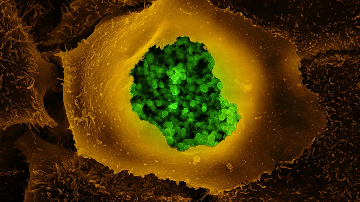 Image microscopique d'une cellule épithéliale humaine infectée avec la bactérie Chlamydia trachomatis