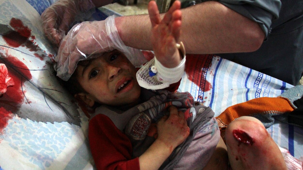 Un enfant en détresse couché sur un lit ensanglanté reçoit des traitements à la tête.