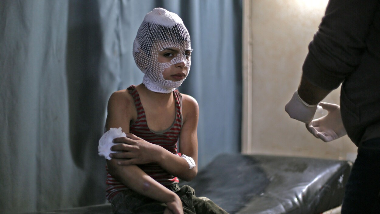 Le jeune garçon, dont le visage est couvert d'un filet tenant des bandages, regarde la caméra.