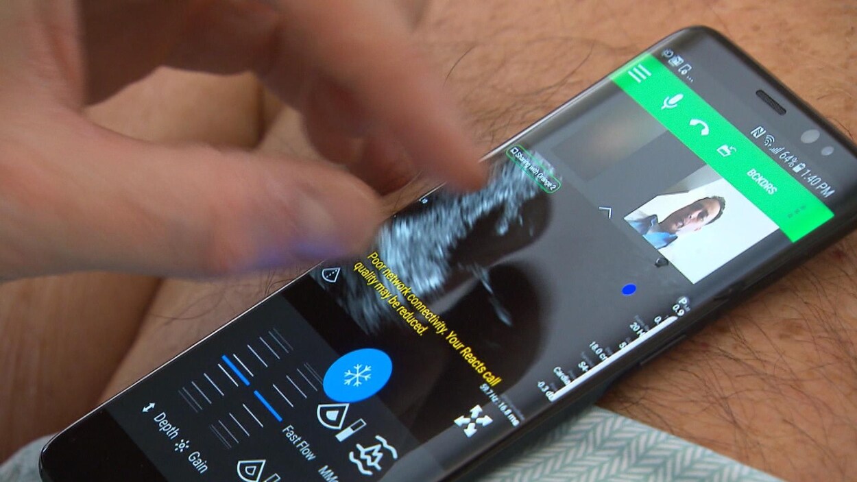 Une application pour des échographies à distance RadioCanada.ca