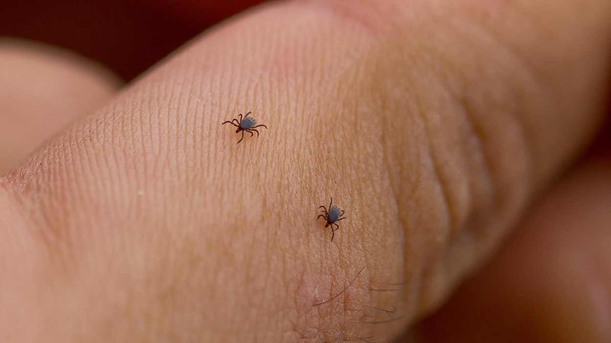 Deux tiques responsables de la maladie de Lyme sur un doigt. Deux tiques responsables de la maladie de Lyme sur un doigt.