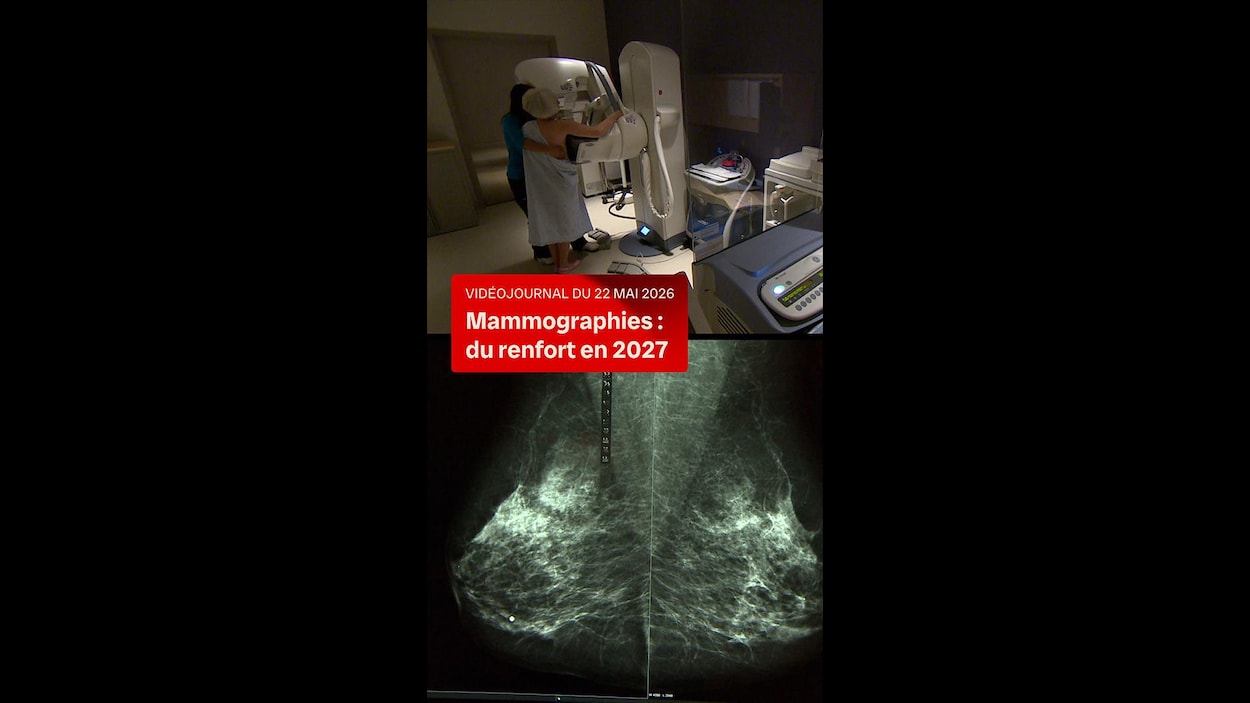 Dépistage du cancer du sein : renfort en 2027 pour Halifax
