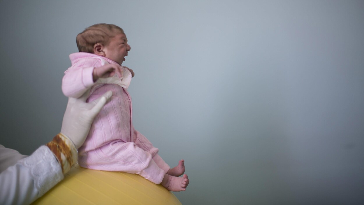 Photo du 12 février 2016 montrant Sophia, âgée de deux semaines et atteinte de microcéphalie, à Campina Grande, au Brésil