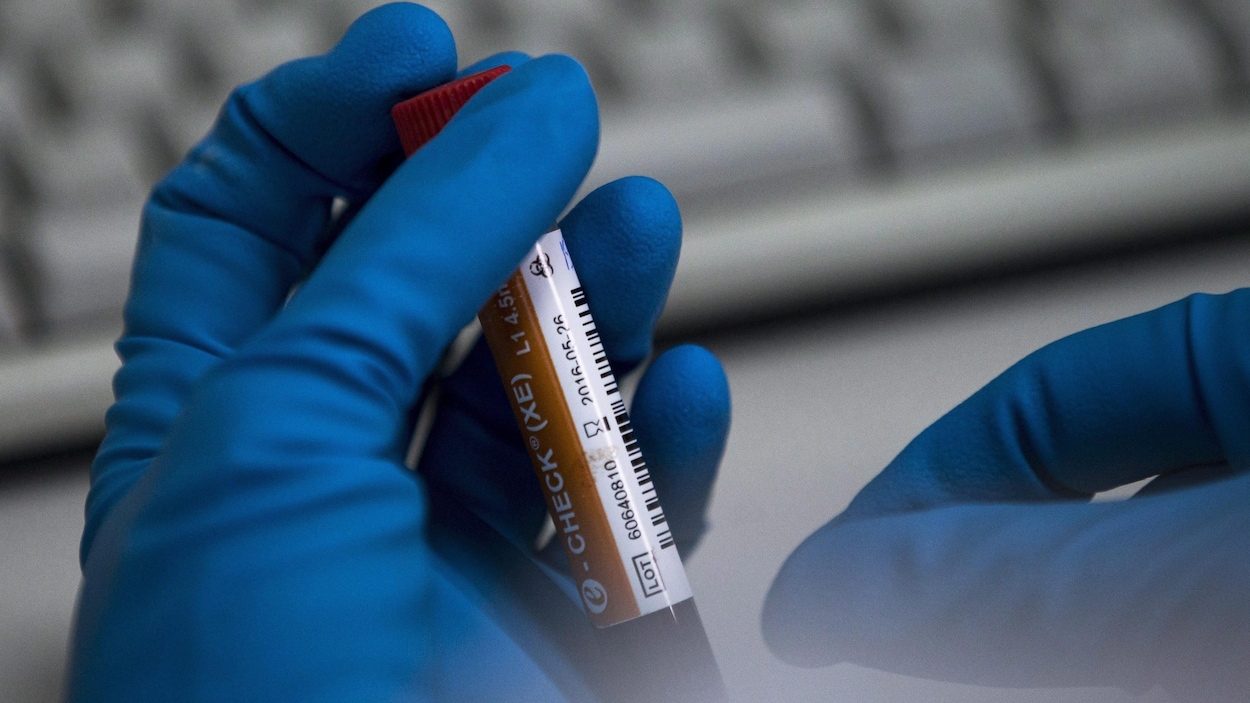 Produit dopant entre les mains d'un technicien