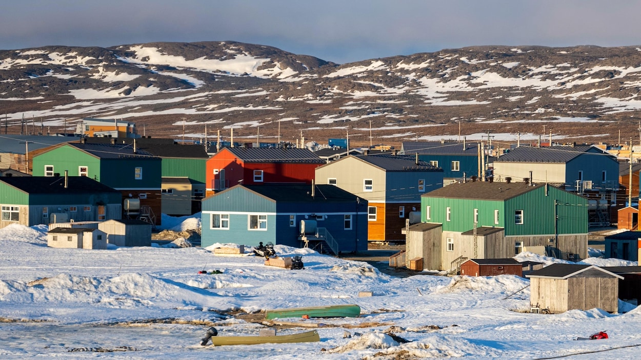 La crise silencieuse de la tuberculose au Nunavik