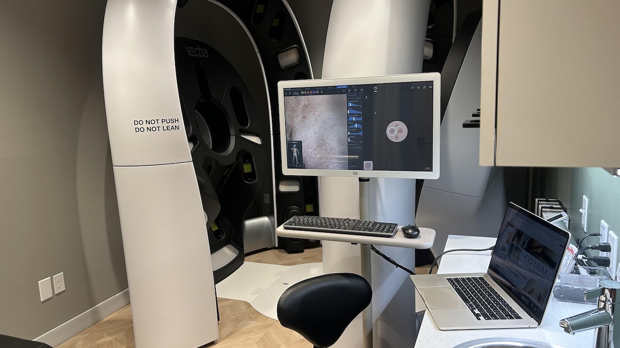 L’intelligence artificielle en renfort pour dépister le cancer de la peau