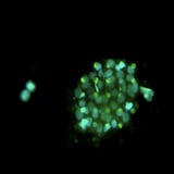 Les cellules tumorales métastatiques se déplacent dans la circulation sanguine sous forme d'amas.