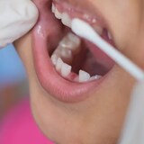 The Liberal-NDP agreement includes a plan to create a new national dental care program for low-income Canadians. (Shutterstock / chanchai plongern)
