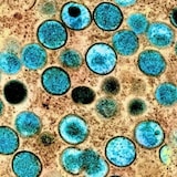 Microscopic view of monkeypox virus.