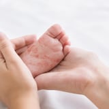 Deux mains tiennent le pied d'un bébé qui a une éruption cutanée.