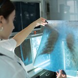 Une radiologue examine un film radiographique thoracique d'un patient dans un laboratoire d'un hôpital.