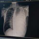 Gros plan d'une radiographie