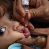 Gros plan sur le visage d'une fillette qui reçoit un vaccin par voie orale.