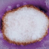 Electron micrograph showing a monkeypox virus particle.