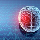 Un cerveau affecté par une commotion cérébrale.