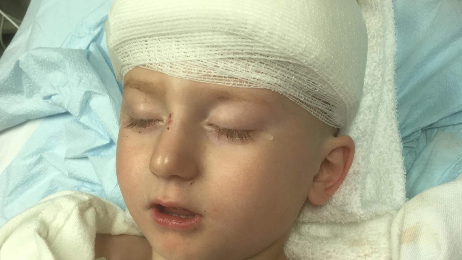 Un petit garçon de trois ans avec les yeux fermés. Il a un bandage sur la tête et une larme qui coule de son oeil gauche.