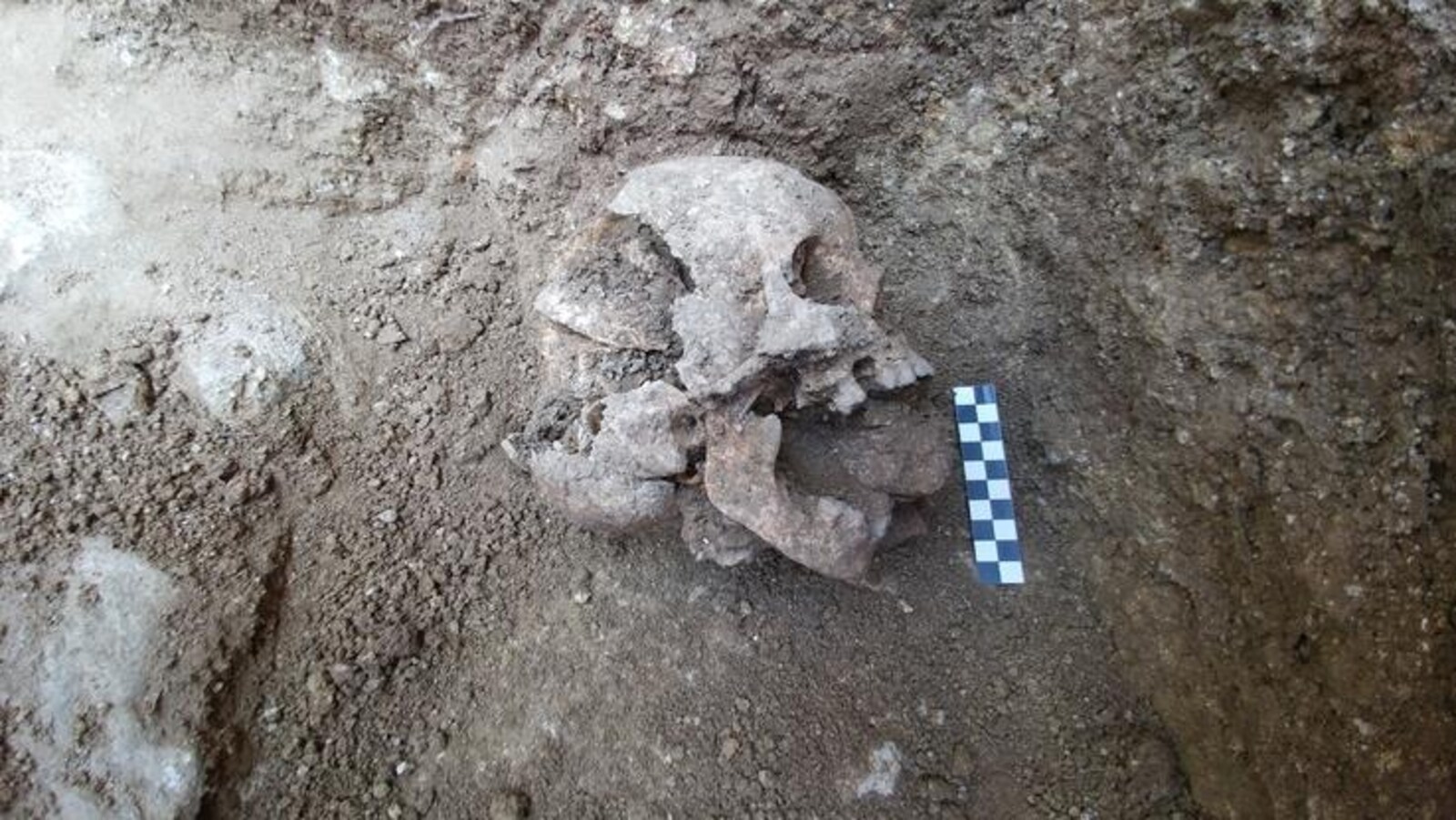 On voit en gros plan le crâne d'un enfant, de profil, déterré à moitié dans une fosse où s'effectuent des fouilles archéologiques.