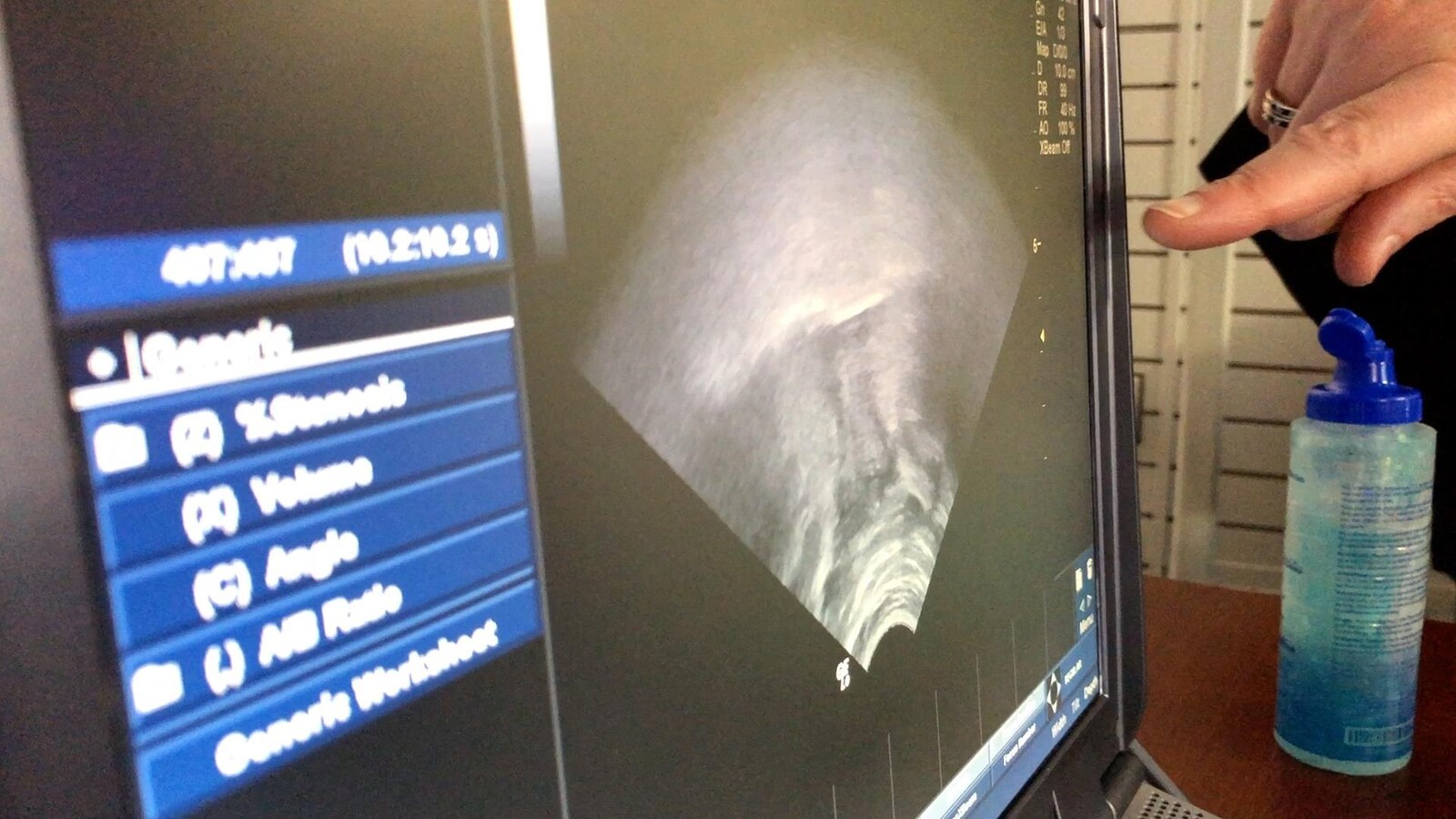 Gros plan sur un écran d'ordinateur et un doigt qui pointe vers une image échographique montrant le mouvement de la langue