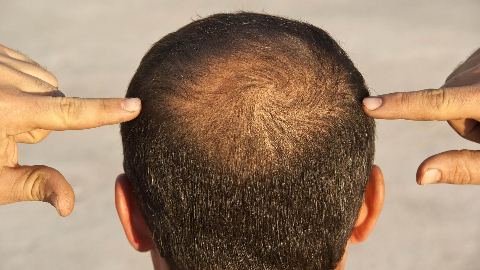 produit contre perte de cheveux produit contre perte de cheveux