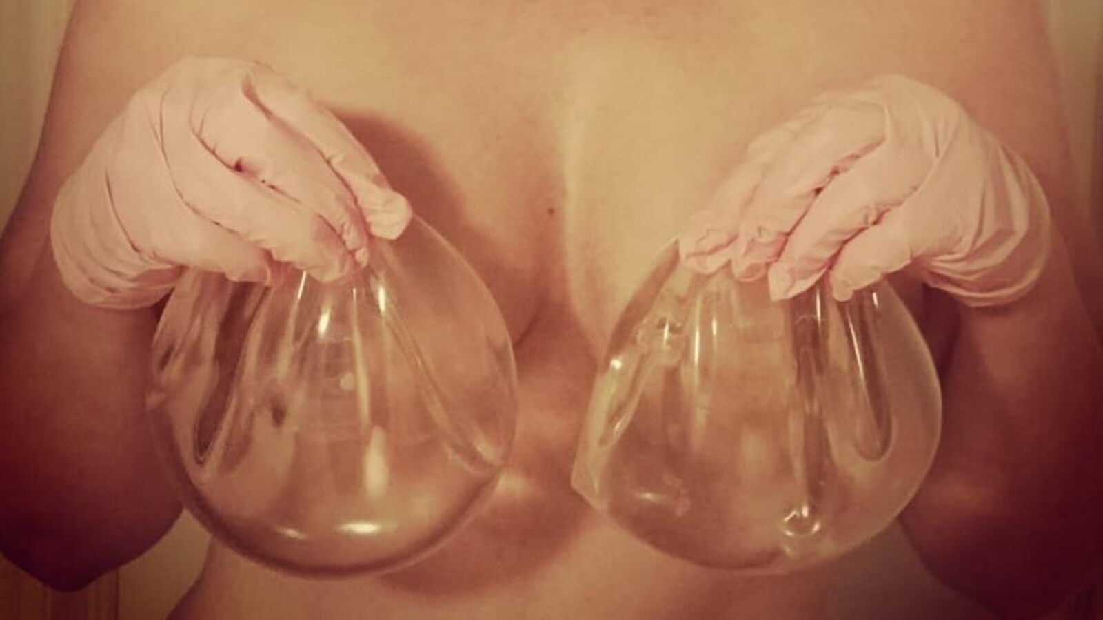 Julie tient de implants mammaires dans ses mains