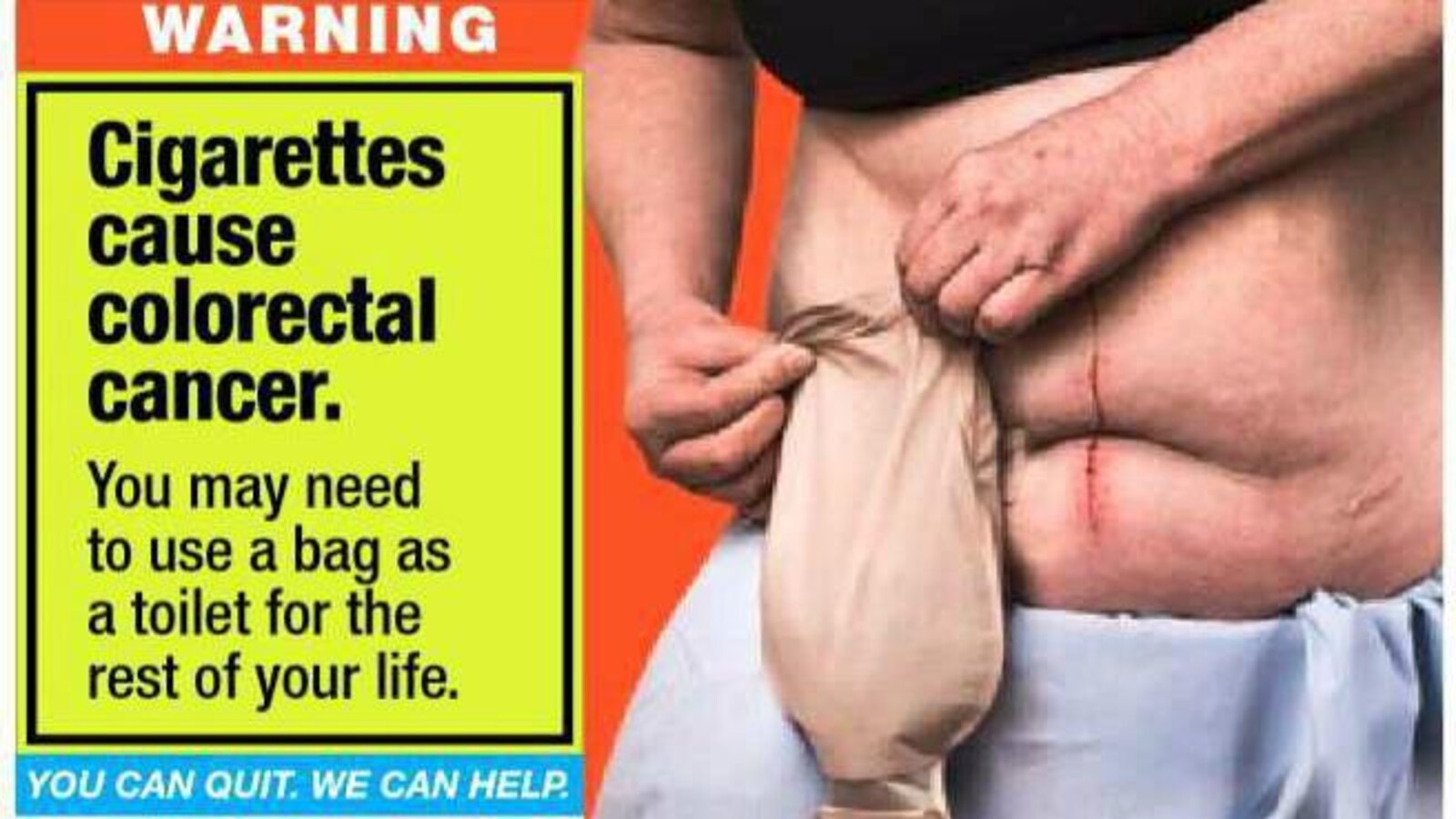 Image d'un paquet de cigarettes avec une image choc montrant un homme avec une poche pour colostomie.