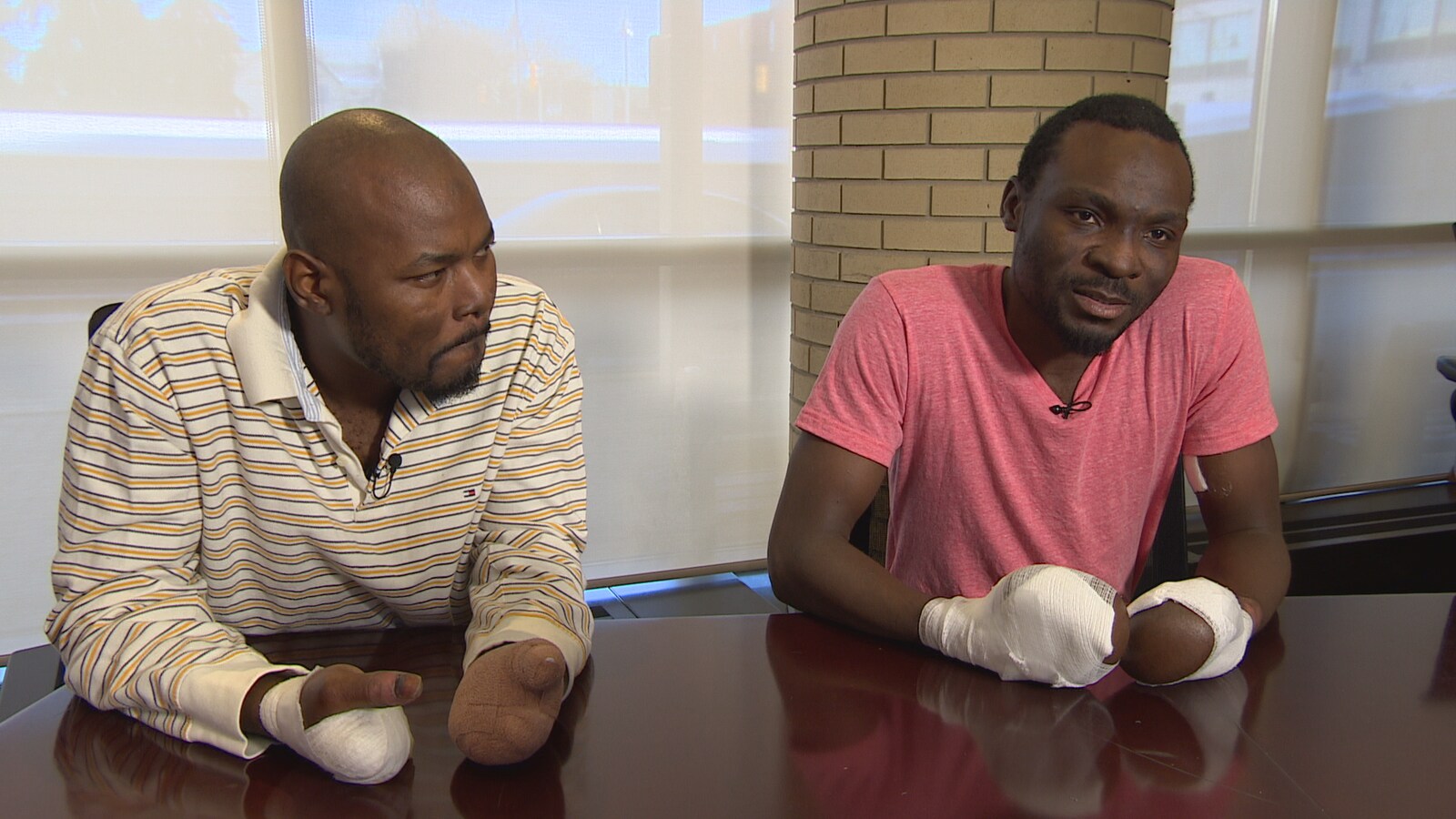 Deux hommes réfugiés assis à une table avec des bandages aux mains.