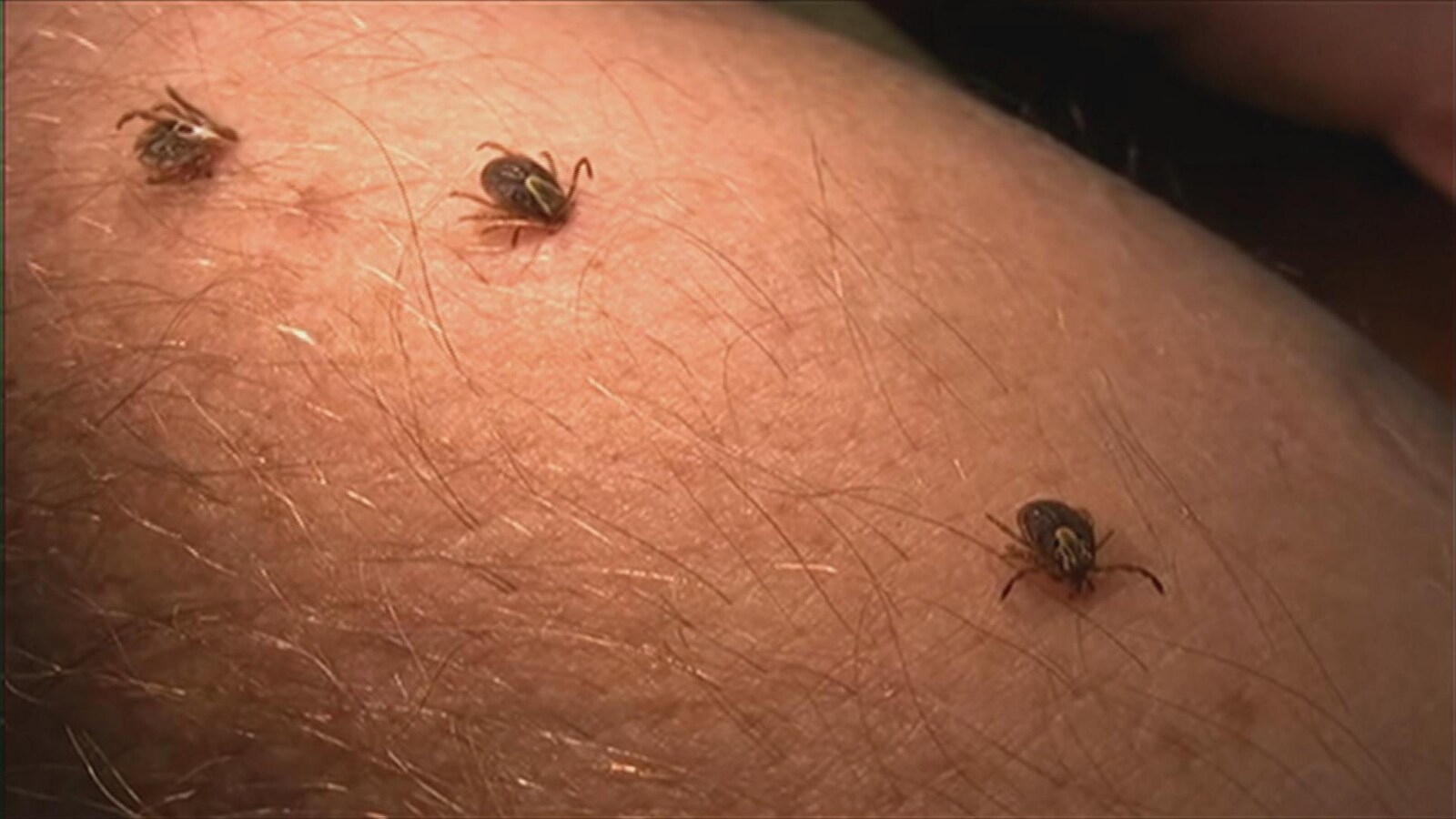 Une morsure de tique peut transmettre la maladie de Lyme