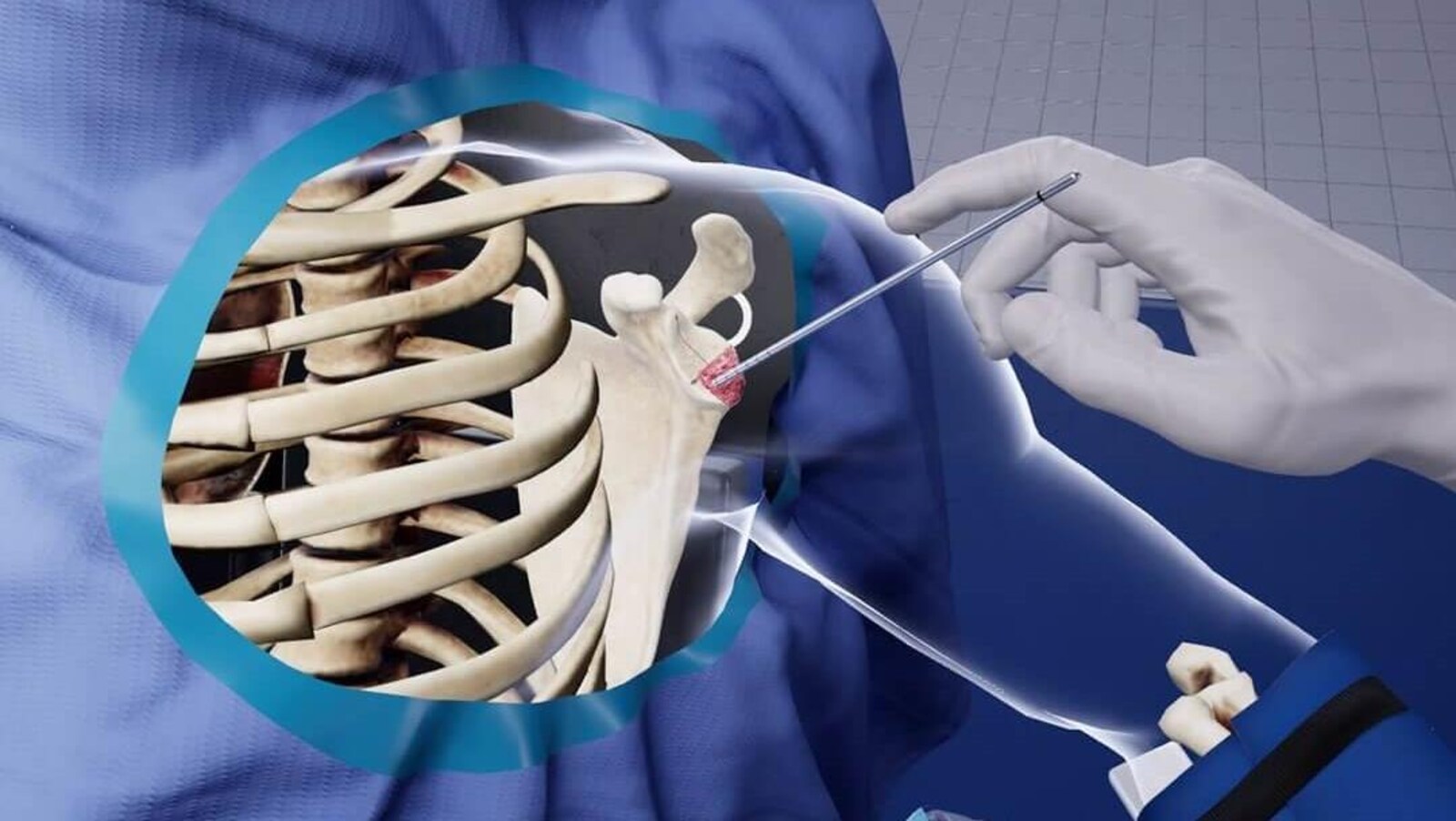 Une image 3D d'une opération, des mains virtuelles procèdent à l'opération d'un os