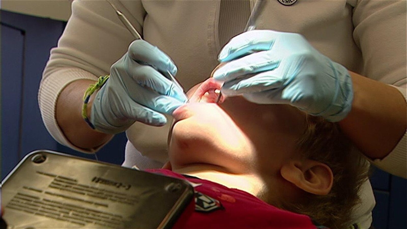 Photo d'un dentiste qui examine les dents d'un enfant couché.