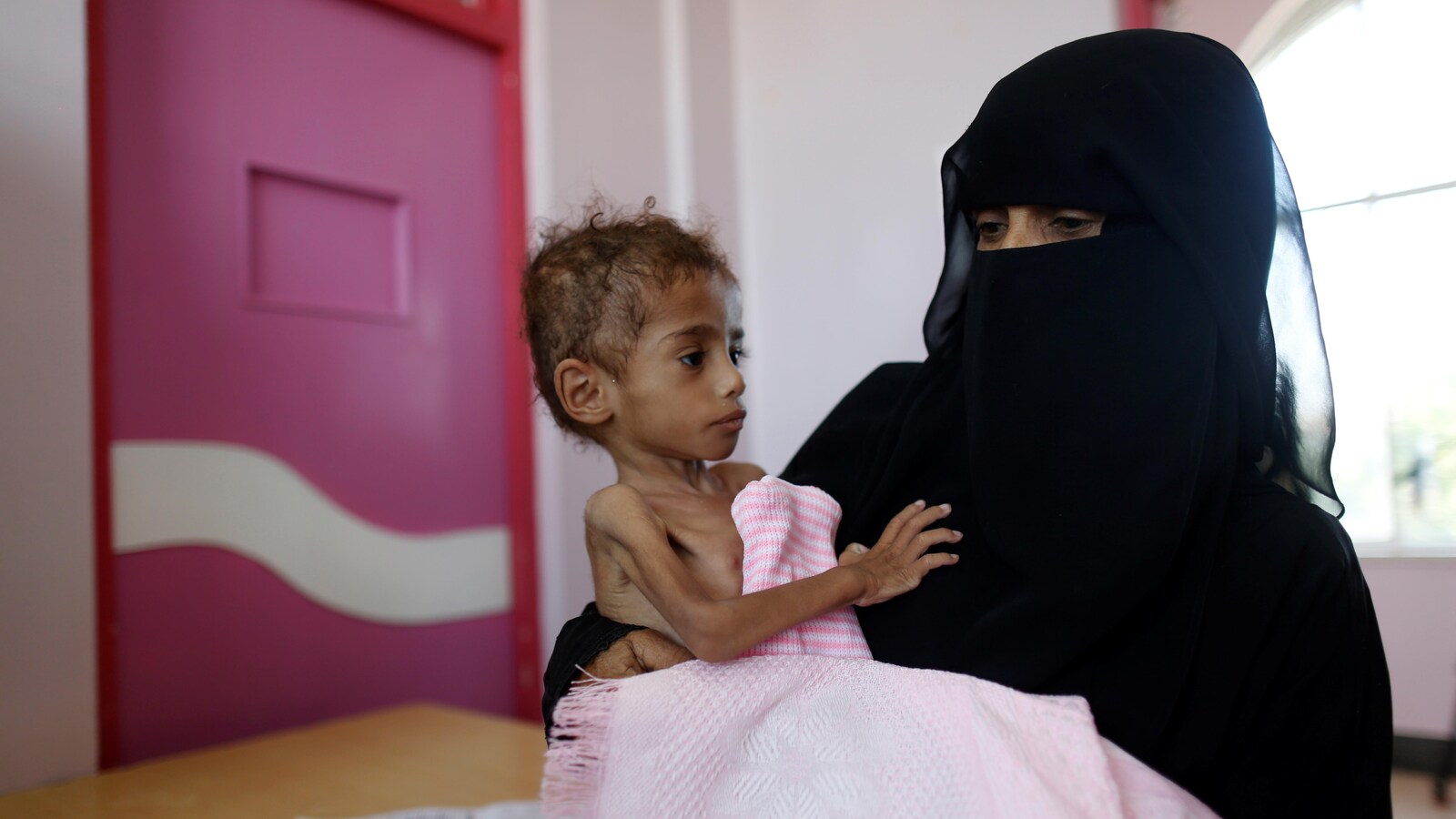 Une mère tient son fils victime de malnutrition dans un centre de traitement à Sanaa au Yémen.