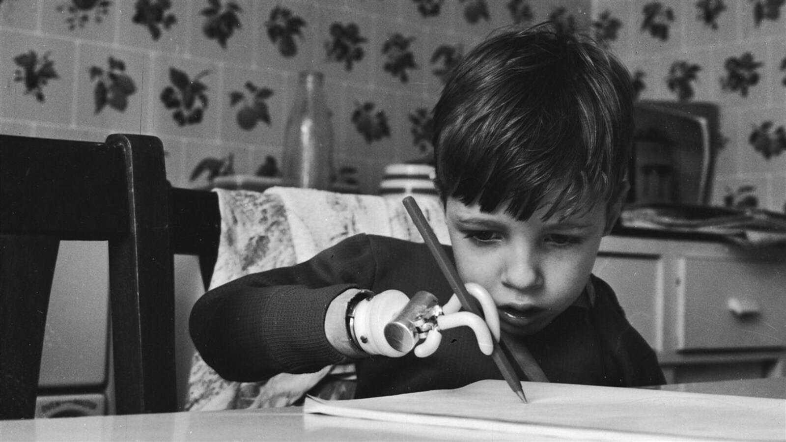 Un petit garçon victime de la thalidomide dans les années 1960.