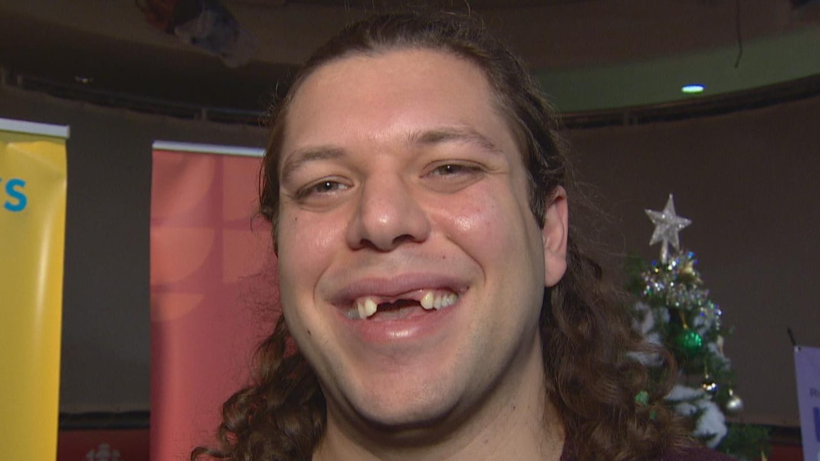 Un homme avec les cheveux longs frisés sourit à la caméra. Il lui manque trois dents en haut à l'avant de sa machoire.
