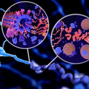 Illustration montrant la phosphorylation de la protéine tau qui entraîne la désintégration des microtubules et l'agrégation en enchevêtrements neurofibrillaires dans l'axone d'un neurone. 