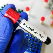 Prise de sang avec la mention «doxycycline» dans la main d'un scientifique.