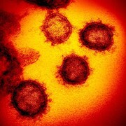 Image provenant d'un microscope électronique du Coronavirus SARS-CoV-2