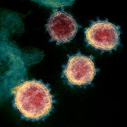 Une image microscopique des cellules du nouveau coronavirus. 