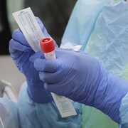 Un tube tenu par une infirmière qui porte des gants médicaux bleus.
