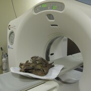 Un fossile dans un appareil d’imagerie médicale